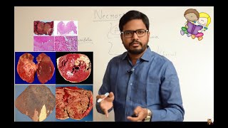 Necrosis amp Types of Necrosis Simplified [upl. by Edison]