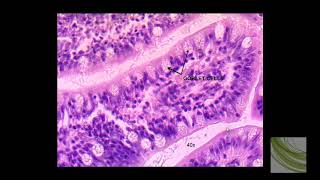 SLIDE Simple Columnar Epithelium [upl. by Ymmik]