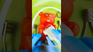 Gummy Surgery Fail😩💔🪦Satisfying Csection flatline DiscountDentist FruitSurgery FoodSurgery [upl. by Noizneb236]