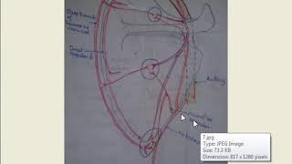 Anastomosis in upper limb around  shoulder amp Elbow [upl. by Llenyr]