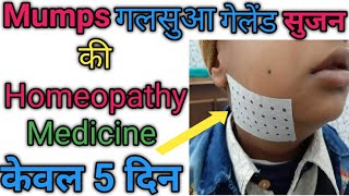 Mumps  गलसुआ  homeopathc medicin for mumps diseases [upl. by Marks]