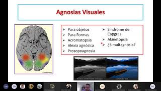 Las agnosias [upl. by Noemi]