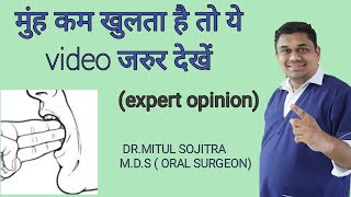 मुन्ह कम खुलने इलाज  Oral submucous fibrosis Causes and Treatment EXPERT ADVICE [upl. by Phare109]