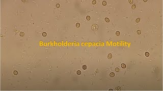 Burkholderia cepacia Motility [upl. by Eilitan415]