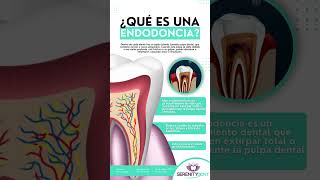 ¿Qué es una endodoncia 🦷🔍endodoncia serenitydent [upl. by Kwarteng443]