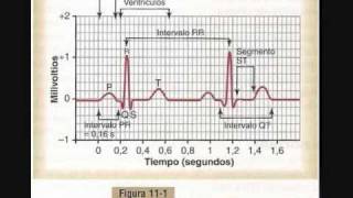 electrocardiogramapiz1wmv [upl. by Michigan801]