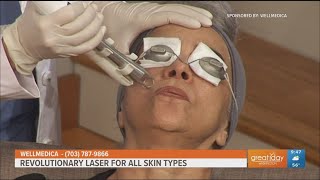 The ULTRACLEAR Laser rejuvenates all skin types [upl. by Anaoy]