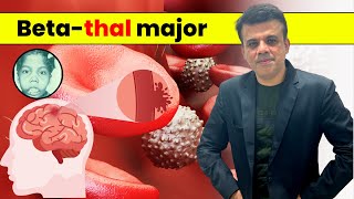 Understanding Beta Thal Major Symptoms amp Treatment Pathology Navigator  Dr Shashikant Adlekha [upl. by Thaxter293]