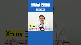 퇴행성관절염 원인과 증상 치료 방법은 [upl. by Assirahc178]