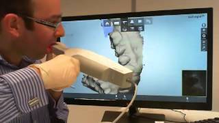 Intra Oral scanning with 3Shape TRIOS [upl. by Akimot]