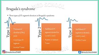 Brugadas syndrome [upl. by Lesoj]