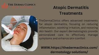 Allergic Dermatitis Treatment [upl. by Downs811]