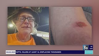 Las Vegas election worker says she was attacked at bus stop [upl. by Nnaeerb471]