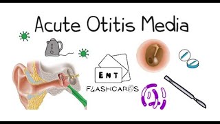 Acute Otitis Media  FRCS ENT Exam Essentials [upl. by Goodard]