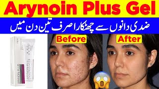 Arynoin Plus Gel 10g  Tretinoin Cream Treatment Of Cystic AcneSkin Care Glowing CreamAcne Cream [upl. by Stempien]