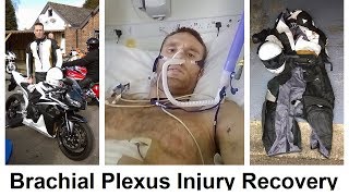 Brachial Plexus Injury Recovery [upl. by Neirbo]