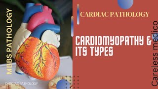 CARDIAC PATHOLOGY Cardiomyopathy amp its typeslecture18mbbs pathology pathoma robbins cvs [upl. by Anitsuga]