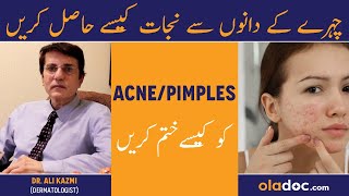 Acne Treatment  Chehre Ke Dano Asan Ka Ilaj  How To Get Rid Of Pimples  Acne Scars Removal [upl. by Mullac]