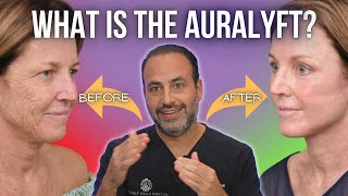 My Face Lifting Technique Explained What is the AuraLyft  Dr Ben Talei  Beverly Hills CA [upl. by Kcirtapnaes]