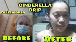 GLUTATHIONE DRIP Review Jherryl Manolong [upl. by Eilama]