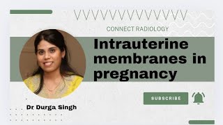 Intrauterine membranes in pregnancy [upl. by Nodnil439]