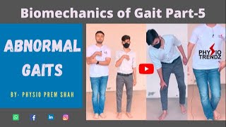 Antalgic gait Hemiplegic gait All Abnormal Gait Demonstration Gait biomechanics [upl. by Nylisoj]