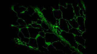 GFP  Endoplasmic reticulum in a plant cell [upl. by Atinej]