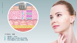 Ultrasound Dynamic MicromassageHIPROL Treatment Video Korean Version [upl. by Eiznekcam]