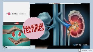 RENAL PATHOLOGY lecture 23 HYDRONEPHROSIS [upl. by Abekam437]