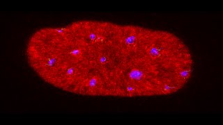 Heterochromatin movement after inhibition of actin polymerisation [upl. by Asilaj]