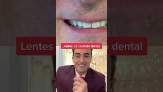 LENTES DE CONTATO DENTAL [upl. by Anoerb]