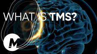 What is TMS How does TMS work MagVenture TMS Therapy [upl. by Yssenhguahs881]