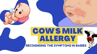 How To Tell If Your Baby Has COWS MILK ALLERGY CMPA  Formula amp Breastfed Infants [upl. by Tartan]