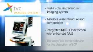 Introduction to the TVC Imaging System™ [upl. by Aizat691]