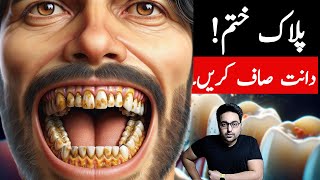 Dr ZeeTop Remedy To get rid of Dental Plaque TARTAR  डॉक्टर ज़ी [upl. by Akirej]