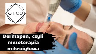 Dermapen czyli mezoterapia mikroigłowa kosmetolog odpowiada  OTCO Clinic [upl. by Donelle]