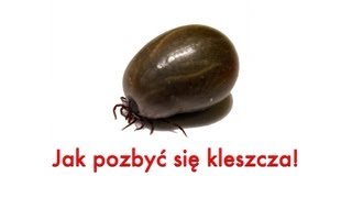 Kleszcz Poradnik jak usunąć kleszcza Wyjmowanie kleszcza [upl. by Mohl547]