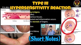 Type III Hypersensitivity Reaction  Serum Sickness Arthritis  Tamil  Immunology  ThiNK Biology [upl. by Sug536]