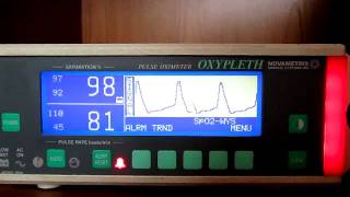 Novametrix 520A [upl. by Gonnella]