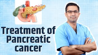 Treatment for Pancreatic Cancer [upl. by Lucia580]