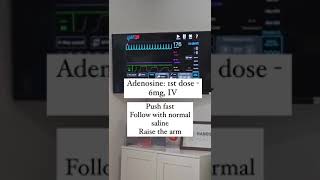 Supraventricular Tachycardia  ECG interpretation [upl. by Aihsilat935]