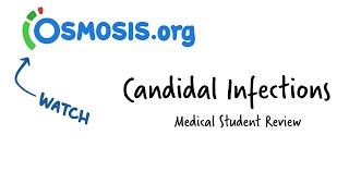 Candidal Infections Osmosis Study Video [upl. by Ecenaj]