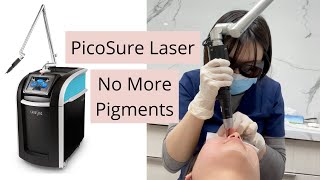 My PicoSure Experience bye bye freckles and pigmentations How does PicoSure laser works [upl. by Bohs]