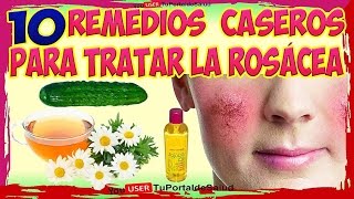 ROSÁCEA  10 REMEDIOS CASEROS Y NATURALES PARA LA ROSACEA [upl. by Elocn602]