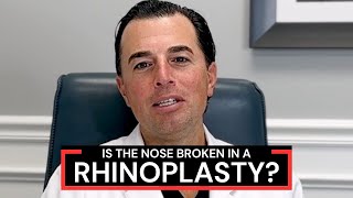 What is Osteotomy During Rhinoplasty Nose Job Surgery  Dr Anthony Corrado [upl. by Lianna]