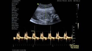 FRECUENCIA CARDÍACA FETAL CUANTO ES NORMAL [upl. by Lanevuj102]