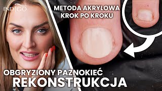 Rekonstrukcja paznokcia akrylem Jak naprawić obgryzione paznokcie krok po kroku  Indigo Nails [upl. by Abehsile]