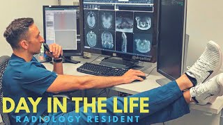 Day in The Life of An Interventional Radiology Resident [upl. by Salis]