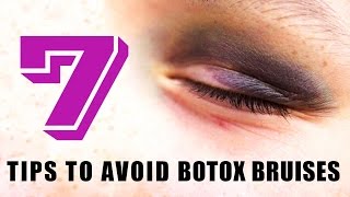 Bruising from Botox  7 tips to avoid Botox Bruises [upl. by Eslek]