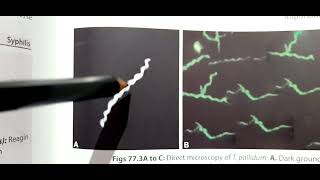 Syphilis Treponema Pallidum  Laboratory Diagnosis  NonTreponemal VDRLRPR and Treponemal test [upl. by Vergil534]